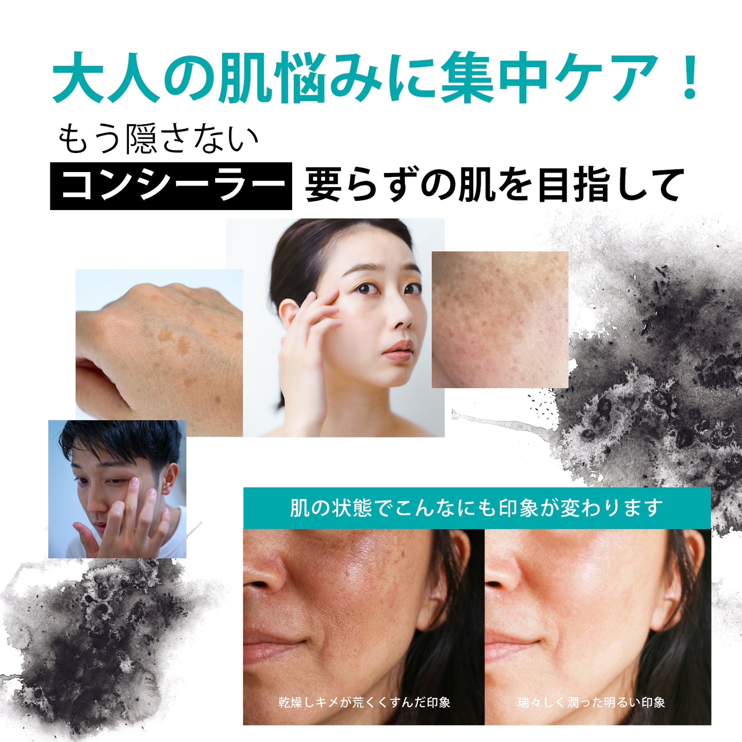 【気になるシミを徹底ケア】 レチノール クリーム ハイドロキノン 5% 配合　MARK AID マークエイド ハイドスピキュールクリーム 15g｜しみ ケアクリーム 天然針（海面）配合