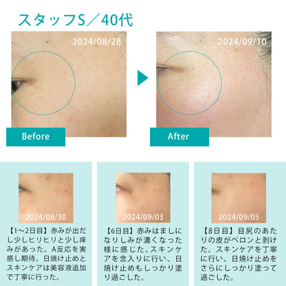 【気になるシミを徹底ケア】 レチノール クリーム ハイドロキノン 5% 配合　MARK AID マークエイド ハイドスピキュールクリーム 15g｜しみ ケアクリーム 天然針（海面）配合