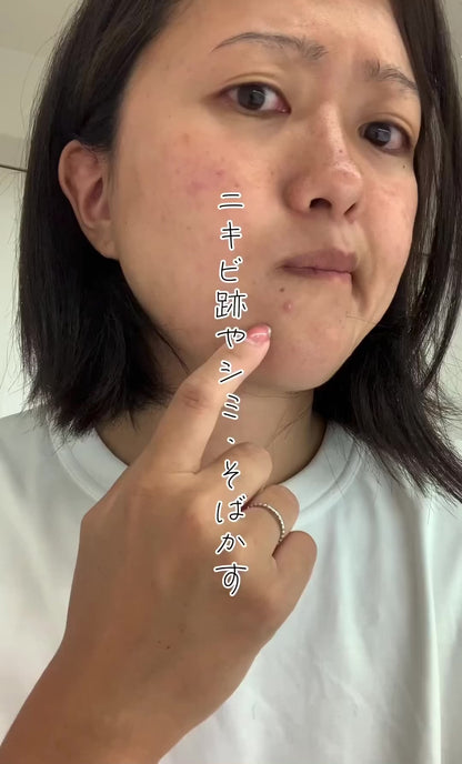 【気になるシミを徹底ケア】 レチノール クリーム ハイドロキノン 5% 配合　MARK AID マークエイド ハイドスピキュールクリーム 15g｜しみ ケアクリーム 天然針（海面）配合